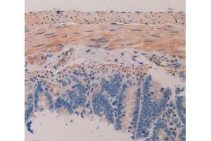 IHC-P analysis of intestine tissue, with DAB staining. (MAP1A antibody  (AA 2110-2367))
