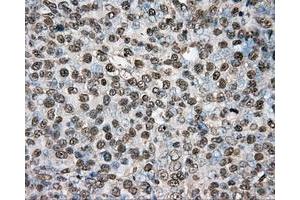 Immunohistochemical staining of paraffin-embedded colon tissue using anti-PTPRE mouse monoclonal antibody.