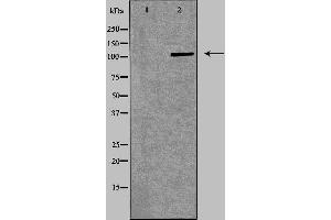 Western blot analysis of Jurkat  lysate using ITGA4 antibody.
