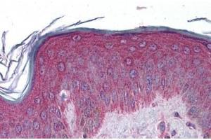 Human Skin: Formalin-Fixed, Paraffin-Embedded (FFPE) (APC2 antibody  (AA 849-898))