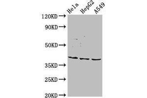 Western Blot Positive WB detected in: Hela whole cell lysate, HepG2 whole cell lysate, A549 whole cell lysate All lanes: NANS antibody at 5. (NANS antibody  (AA 132-259))