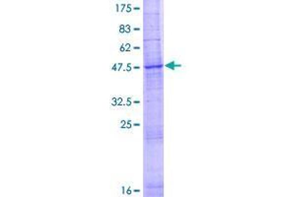 Solute Carrier Family 35 (UDP-GlcNAc/UDP-Glucose Transporter), Member D2 (SLC35D2) (AA 1-249) protein (GST tag)