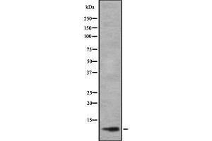 Western blot analysis of TAL2 using HuvEc whole cell lysates (TAL2 antibody  (C-Term))