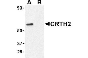 Western blot analysis of CRTH2 in Jurkat cell lysate with CRTH2 antibody at 1 µg/mL in (A) the absence and (B) presence of blocking peptide. (Prostaglandin D2 Receptor 2 (PTGDR2) (N-Term) antibody)