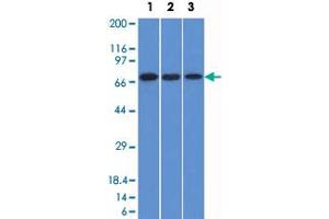 Western Blot analysis of Lane 1: HeLa, Lane 2: A431 and Lane 3: HL-60 cell lysates with ENG monoclonal antibody, clone ENG/1326 . (Endoglin antibody  (AA 74-251))