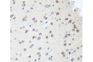 Immunohistochemistry of paraffin-embedded Rat brain using SAP18 Polyclonal Antibody at dilution of 1:100 (40x lens). (SAP18 antibody)