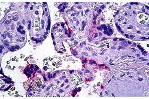 Human Placenta: Formalin-Fixed, Parraffin-Embedded (FFPE) (DOK3 antibody  (AA 484-496))