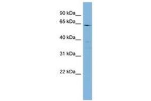 Image no. 1 for anti-Cytochrome P450, Family 4, Subfamily F, Polypeptide 3 (CYP4F3) (AA 35-84) antibody (ABIN6741778) (CYP4F3 antibody  (AA 35-84))