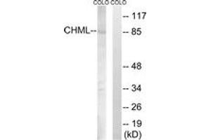 Western blot analysis of extracts from COLO cells, using CHML Antibody. (CHML antibody  (AA 128-177))