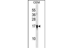 Western blot analysis in CEM cell line lysates (35ug/lane). (FAM163A antibody  (AA 32-61))