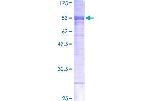 Image no. 1 for Carboxylesterase 1 (CES1) (AA 1-566) protein (GST tag) (ABIN1349172) (CES1 Protein (AA 1-566) (GST tag))