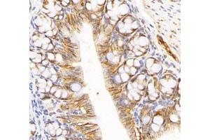 Immunohistochemistry of paraffin embedded mouse colon using ATP1A1 (ABIN7073154) at dilution of 1: 500 (400x lens) (ATPase (Na/K) antibody)