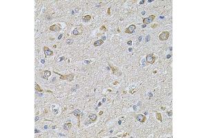 Immunohistochemistry of paraffin-embedded rat brain using FASTKD1 Antibody. (FASTKD1 antibody  (AA 638-847))