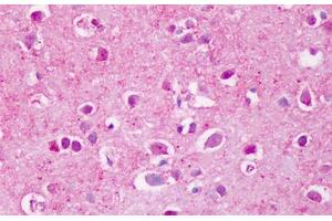 PTPRA antibody  (Extracellular Domain)