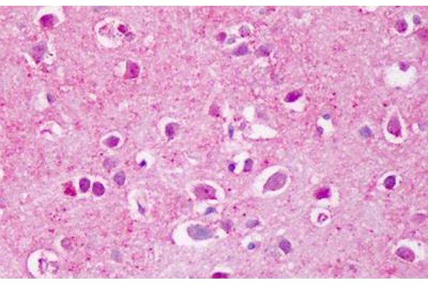 PTPRA antibody  (Extracellular Domain)