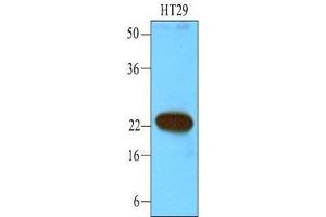 Cell lysates of HT29 (40 ug) were resolved by SDS-PAGE, transferred to nitrocellulose membrane and probed with anti-human CIB1 (1:1000). (CIB1 antibody  (AA 1-191))