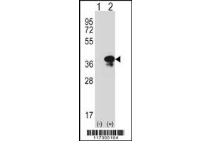 Western blot analysis of STX3 using rabbit polyclonal STX3 Antibody using 293 cell lysates (2 ug/lane) either nontransfected (Lane 1) or transiently transfected (Lane 2) with the STX3 gene. (STX3 antibody  (AA 178-205))