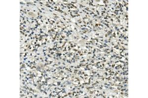 IHC analysis of UBE3A using anti-UBE3A antibody (ABIN7599562). (ube3a antibody  (AA 1-860))