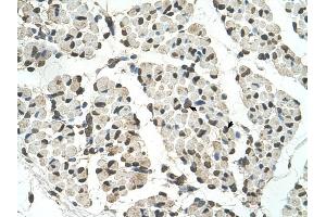 PSD3 antibody was used for immunohistochemistry at a concentration of 4-8 ug/ml to stain Skeletal muscle cells (arrows) in Human Muscle.