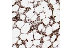Immunohistochemical staining of human NFE2 polyclonal antibody  shows strong nuclear positivity in bone marrow poietic cells at 1:50-1:200 dilution.