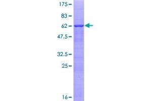 Activator of Basal Transcription 1 Protein (Abt1) (AA 1-272) (GST tag)