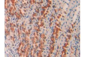 DAB staining on IHC-P; Samples: Rat Stomach Tissue (COL2A1 antibody  (AA 1226-1331))