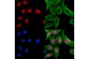 ABIN7094276 and ABIN7098323 staining Hela cells by IF/ICC. (Histone Cluster 1, H1t (HIST1H1T) (Internal Region) antibody)