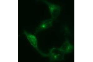 Image no. 1 for anti-Synaptophysin (SYP) antibody (ABIN1501255) (Synaptophysin antibody)