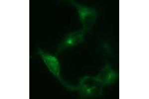Image no. 1 for anti-Synaptophysin (SYP) antibody (ABIN1501255)