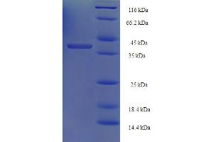 SDS-PAGE (SDS) image for RAD52 Homolog (S. Cerevisiae) (RAD52) (AA 60-282), (partial) protein (His-SUMO Tag) (ABIN5711075)