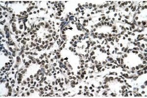 Human Lung; ZNF706 antibody - N-terminal region in Human Lung cells using Immunohistochemistry (ZNF706 antibody  (N-Term))