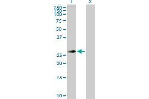Lane 1: TSSK3 transfected lysate ( 30. (TSSK3 293T Cell Transient Overexpression Lysate(Denatured))