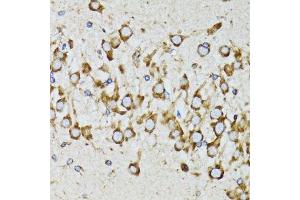 Immunohistochemistry of paraffin-embedded mouse brain using RPN1 antibody.
