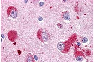 Image no. 1 for anti-G Protein-Coupled Receptor 151 (GPR151) (C-Term) antibody (ABIN1048739) (GPR151 antibody  (C-Term))