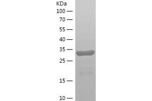 Western Blotting (WB) image for Semenogelin I (SEMG1) (AA 25-235) protein (His tag) (ABIN7282678) (SEMG1 Protein (AA 25-235) (His tag))