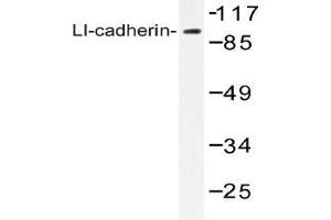 Western blot (WB) analysis of LI-cadherin antibody in extracts from Jurkat cells. (LI Cadherin antibody)
