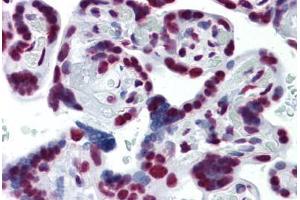 Human Placenta: Formalin-Fixed, Paraffin-Embedded (FFPE) (CDKL1 antibody  (AA 259-358))