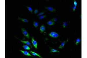 Immunofluorescence (IF) image for anti-Signal Sequence Receptor gamma (SSRg) (AA 77-135) antibody (ABIN7172922)