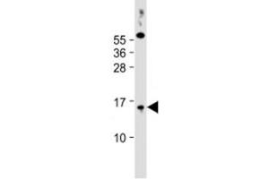 Western blot testing of human PC-3 cell lysate with SYNJBP antibody at 1:2000. (SYNJ2BP antibody  (AA 22-66))