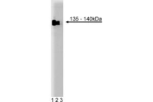 Western Blotting (WB) image for anti-General Transcription Factor III (GTF2I) (AA 17-123) antibody (ABIN968264) (GTF2I antibody  (AA 17-123))