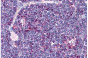 Human Thymus (formalin-fixed, paraffin-embedded) stained with CD99 antibody ABIN239808 at 10 ug/ml followed by biotinylated anti-mouse IgG secondary antibody ABIN481714, alkaline phosphatase-streptavidin and chromogen. (CD99 antibody)
