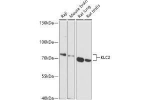 Western blot analysis of extracts of various cell lines, using KLC2 antibody (ABIN7268140) at 1:1000 dilution. (KLC2 antibody  (AA 1-90))