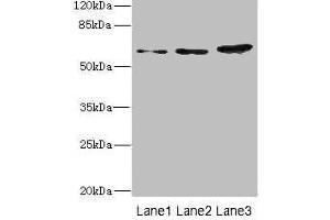 Western blot All lanes: ERVFRD-1 antibody at 3. (HERV-FRD Provirus Ancestral Env Polyprotein (Herv-frd) (AA 16-250) antibody)