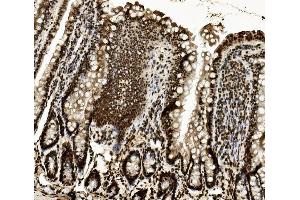IHC analysis of DDX5 using anti-DDX5 antibody (ABIN7602561).