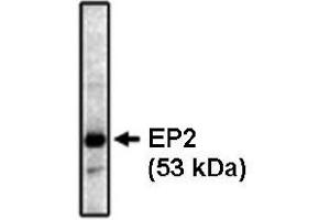 Western Blotting (WB) image for anti-Prostaglandin E Receptor 2 (Subtype EP2), 53kDa (PTGER2) antibody (ABIN264447) (PTGER2 antibody)