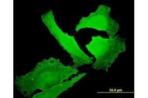 Image no. 3 for anti-Erythrocyte Membrane Protein Band 4.1 (Elliptocytosis 1, RH-Linked) (EPB41) (AA 116-226) antibody (ABIN598666) (EPB41 antibody  (AA 116-226))