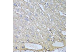 Immunohistochemistry of paraffin-embedded human liver using RPH3AL antibody at dilution of 1:100 (40x lens).
