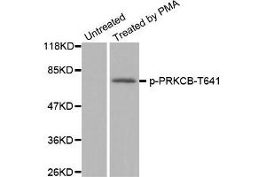 Western Blotting (WB) image for anti-Protein Kinase C, beta (PRKCB) (pThr641) antibody (ABIN1870521) (PKC beta antibody  (pThr641))