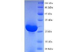 SDS-PAGE (SDS) image for Protease, serine, 1 (Trypsin 1) (PRSS1) (AA 24-246) protein (His tag) (ABIN5713758) (PRSS1 Protein (AA 24-246) (His tag))
