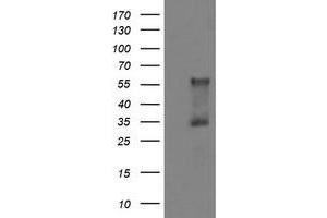 HEK293T cells were transfected with the pCMV6-ENTRY control (Left lane) or pCMV6-ENTRY DOK7 (Right lane) cDNA for 48 hrs and lysed. (DOK7 antibody)